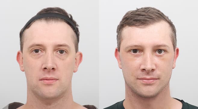 Slider image (2) AB Plastic Surgery